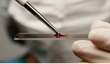 全自動微量元素分析儀檢測的全血微量元素參考範圍多少正常檢測方法 全自動微量元素分析儀檢測的全血微量元素參考範圍多少正常檢測方法